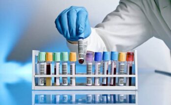 Lab image